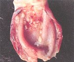 圖2：膀胱破裂、粘膜出血、膀胱頸附近有結石。