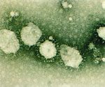 圖3：電子顯微鏡負染色觀察，可見典型冠狀病毒表面近圓形的多數約 20 nm 大小之棘突