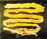 圖3：小腸黏膜上皮肥厚增生，小腸內有綠色內容物，盲腸扁桃出血。