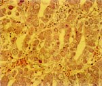 圖3：腸黏膜上皮含大量球蟲囊及配子體。