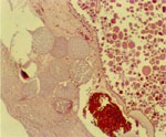 圖4：輸卵管肌層可見第二代裂殖體（Schizont）及欲釋放的裂殖子（Merozoites）寄生於組織中，而在病灶周圍有少許炎症細胞浸潤及出血。