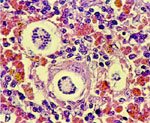 圖3：肝簇蟲裂殖體中央為殘存體，周圍濃染者為裂殖子H&E stain × 200
