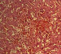 圖１：豬，肝組織相。敗血(症)型沙氏桿菌症鏡下，肝小葉呈多發局部壞死灶，壞死的肝索細胞消失，而RBC取而代之，而蓄積於壞死區。
