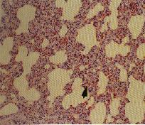 圖3：豬，肺組織相。敗血(症)型沙氏桿菌症。鏡下，於病灶區可見肺泡壁增厚，肺泡上皮細胞、間質細胞及吞噬細胞增生。