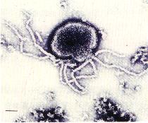 圖4：病灶肺臟組織，製成乳劑行負染色，於穿透式顯微鏡下，可檢出部份破裂具nucleocapsid之paramyxovirus病毒顆粒。