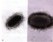 圖4(a)(圖左)： 口唇丘疹及潰瘍部位組織，製成乳劑行負染色，於穿透式電子顯微鏡下可發現 M-form之Orf 病毒粒子。圖4(b)(圖右)：C-form之Orf 病毒粒子。