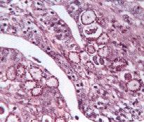 圖2：羊，球蟲症小腸組織相。鏡下小腸絨毛上皮細胞增生並呈急性腫脹，且見球蟲的配子體蓄積於細胞質內