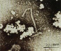 圖4：將呈現HA陽性反應之尿囊液，經負染色，在穿透式電子顯微鏡下，可見部份破裂的病毒顆粒游離出具herring bone形成之nucleocapsid，此為paramyxovirus病毒顆粒的特徵，100,000 X