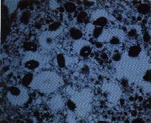 圖3：皮膚組織超薄切片：在穿透式電子顯微鏡下，可見到橢圓形，核為啞鈴狀之病毒顆粒。 (1.5萬倍)