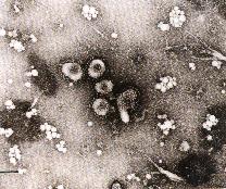 圖4：自雞胚分離出之病毒，以負染色於穿透式電子顯微鏡下可見冠狀病毒粒子。