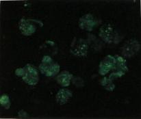 圖4：將病材接種於MDCCMSB1細胞株七代連續繼代後，以間接螢光免疫法染色，可見特異CAV 螢光。