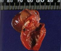 圖3：心內膜有一直徑 2mm灰白色突起腫塊，且部分區域心肌有灰白斑出現。