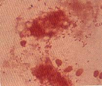 圖2：肝臟直接抹片行革蘭染色可見大量兩端濃染之革蘭氏陰性桿菌