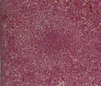 圖3：肝臟多發局部壞死、肝細胞腫脹竇間隙中充塞大量紅血球。H & E stain X100