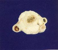 圖2：盲腸單側腫脹，內容呈乾酪樣。