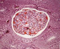 圖2：鴨胃蟲侵入腺胃腺管腔內造成腺體擴張、但常無炎症反應。H & E stain(雌性蟲體內含大量蟲卵)X40。