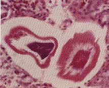 圖4：雄性蟲體具明顯的消化道及生殖細胞。H & E stain X400