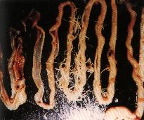圖1：腸腔內有多數蟲體寄生。