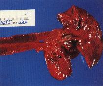 圖2：氣管粘膜潮紅出血，可見塊狀凝血塊於粘膜上。