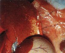 圖3：肝臟：肝細胞腫大、細胞界限明顯、邊緣鈍圓、看可見白色壞死點散發。