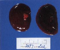 圖4：泌尿系統：雙側腎臟漿膜面及切面皆呈暗黑色、細看可見密發出血點。