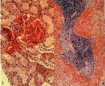 圖6：a：脾：嚴重出血，白髓萎縮。