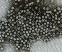 圖7：脾乳劑行負染色於穿透式電子顯微鏡下可見多數Calicivirus. bar=100nm