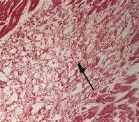 圖2：高倍同上所見(Masson