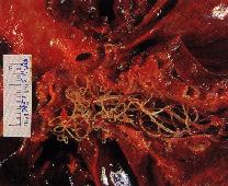 圖2：肺血管腔內充滿白色絲狀蟲體。