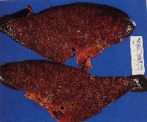 圖4a：肺臟之切片：每一葉肝小葉清晰可見，呈紅白相間樣排列。