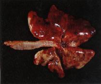 圖2：肺臟表面出現多發、大小 0.5 至 3 公分、暗紅色的出血斑 