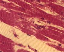 圖3：心肌微血管內皮細胞中之裂殖體。(箭頭)