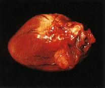 圖１：心臟外觀呈現圓化，並可見蟲體寄生於肺動脈。