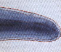圖4：蟲體頭部之顯微結構。