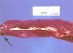 圖1：野外豬瘟病毒（宜蘭分離株）人工感染 SPF 豬，第六天，剖檢可見脾臟呈 0.5cm 大小之紅色扇形梗塞區（箭頭 ）。