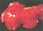 圖2：肝臟密發黃白色 1～2mm 壞死點。