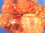 圖1：肺濕重，兩側膈葉腫脹不塌陷，呈大區域出血灶，肺肋膜面覆著黃白色纖維素物。