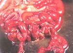 圖3：大小腸瀰漫性出血，粘膜局部少量偽膜附著（急性期）。