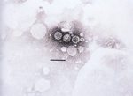 圖3：牛輪狀病毒完整顆粒直徑約 65nm，呈輪狀，有兩層蛋白衣，內層放射如輪軸，外層圍繞如輪圈。