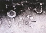 圖4：牛冠狀病毒直徑約 180nm，呈球狀，封套上有花瓣狀突起物成環而看似皇冠。