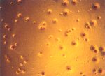 圖3：Mycoplasma capricolum 於固體培養基三十七度，四十八小時培養之荷包蛋樣菌落形態。