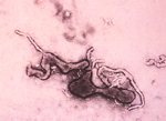 經負染色之 Mycoplasma capricolum 於電子顯微鏡下的多形性菌體型態。