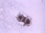 圖6：電子顯微鏡下可見披衣菌菌體。
