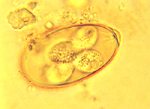 圖4：蟲卵經 24～48 小時孵化後可見具有四個孢子囊。
