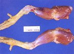 圖2：膝關節周圍組織含部份漿液性滲出液，腓腹腱呈明顯出血灶。