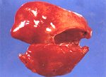 圖3：剖檢時可見肝臟潮黃且腫大，有點狀或斑塊狀出血灶廣泛性散播於肝臟表面。