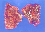 圖3：雙側肺葉極度潮紅及充血。