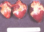 圖2：右心室衰竭、心臟腫大呈鈍圓。