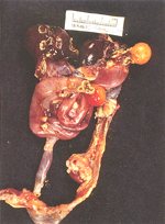 圖2：內臟可見有多處直徑 0.3cm～1cm 之火山口樣的潰瘍灶。
