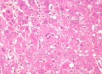 圖4：處理組大鼠肝細胞腫脹及有絲分裂現象增加。